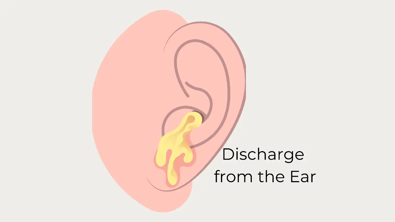 causes of ear discharge
