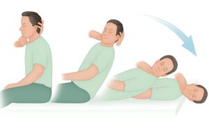 ILLUSTRATION OF DIX HALLPIKE TEST FOR BPPV