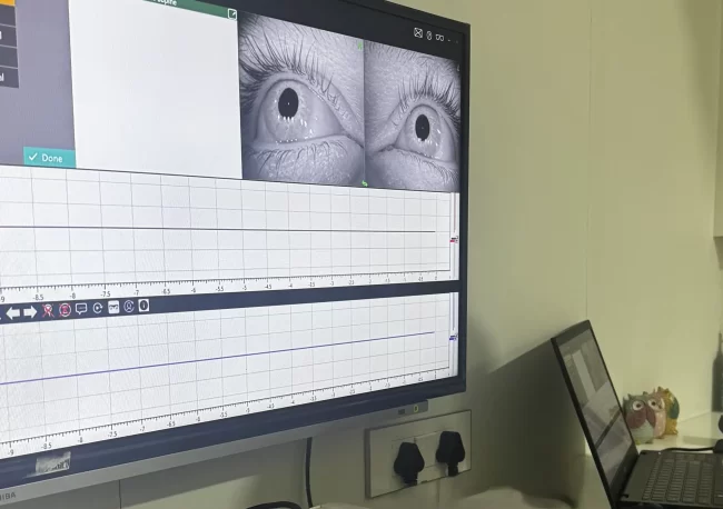 ENT specialist performing a VNG test on a patient, tracking eye movements to diagnose the cause of dizziness and vertigo in Navi Mumbai