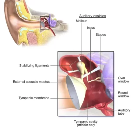diagram showing middle ear structures involved in hearing-improving surgery