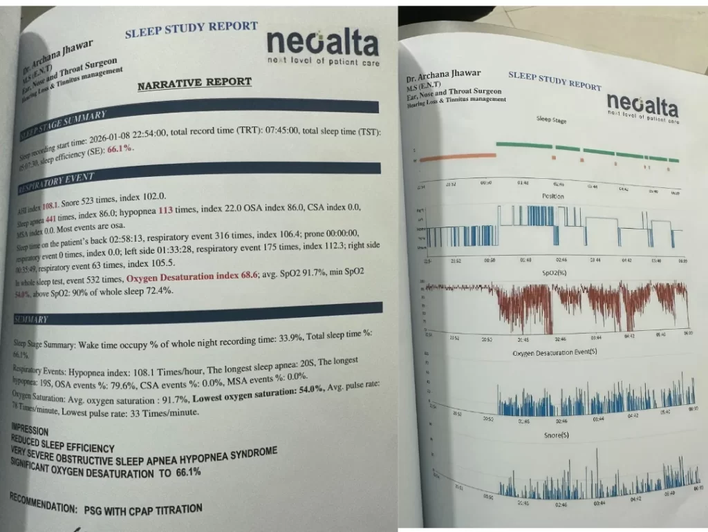 sleep study report showing sleep stages, oxygen levels, body positions and snoring